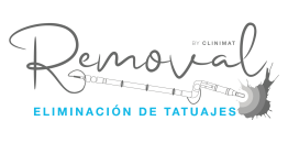 Eliminación de tatuajes en Mataró y Maresme